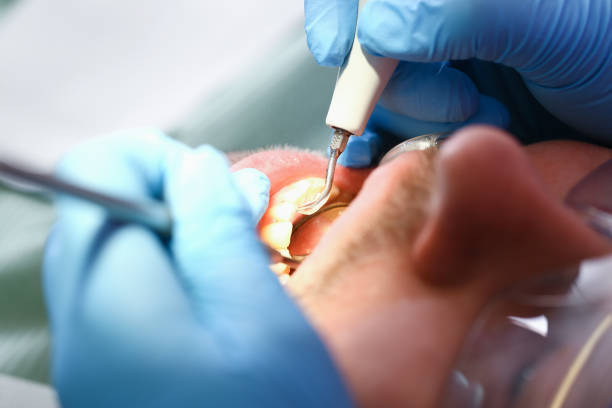 Best Emergency Dental Services for Seniors in Goleta, CA