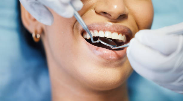 Best Pediatric Emergency Dentist in Goleta, CA