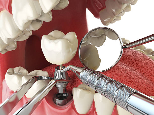 Best Emergency Cosmetic Dentistry in Goleta, CA